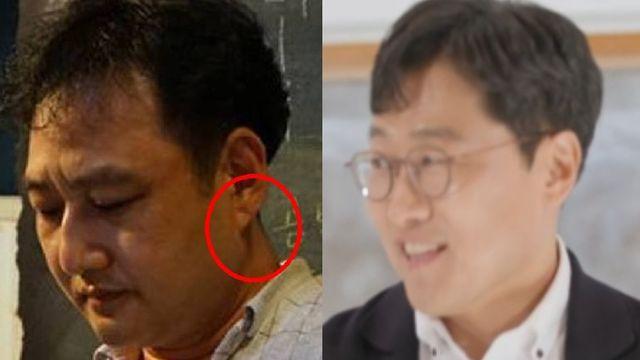 '귓볼 주름' 김수용 이어…김상욱 교수도 '심근경색' 전조 증상? 