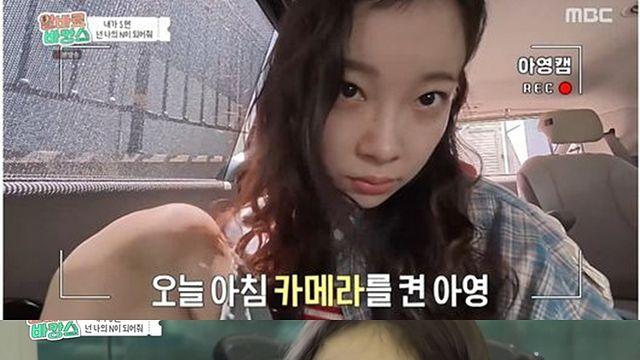 [TVis] 김아영, 출국 몇 시간 전 응급실行…“새끼발가락 찢어져 꿰맸다” (알바로)