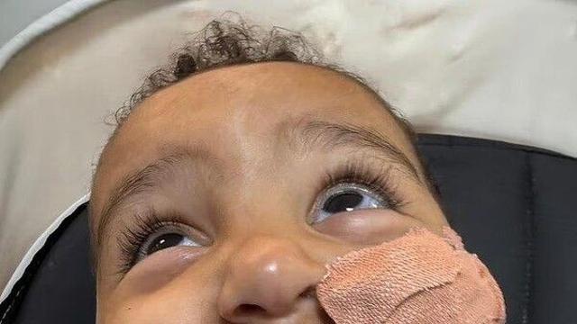 배수관 세정제 마신 18개월 아기…심장마비 겪고 입술 붙어