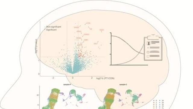 KAIST “우울증, 몸 전체 면역반응 이상과 연관”…면역·신경축 불균형 지적