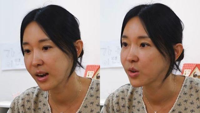 이지혜, 시술 부작용? 달라진 얼굴→촬영 취소…