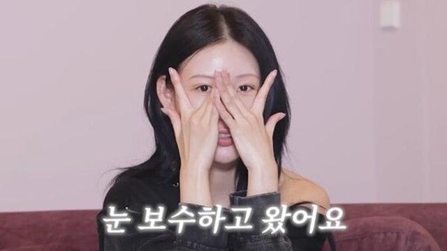 이사배, 쌍꺼풀 수술 고백…