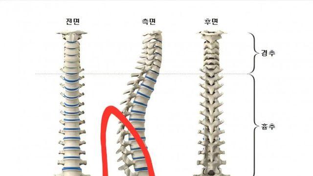 시디즈가 허리 아픈 이유(좋은 럼버서포트 기준)