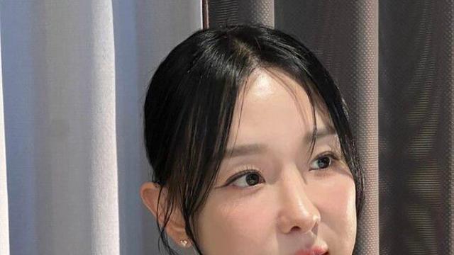 이지혜, 인중축소 수술 후 달라진 얼굴…인형 미모