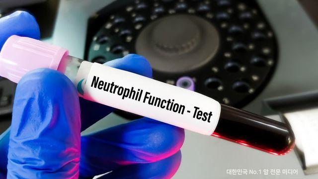 만성골수성백혈병, 항암제 치료 효과 예측 가능