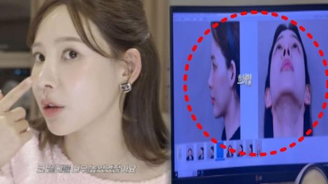 '환승연애2' 이나연, 코 재수술 근황 