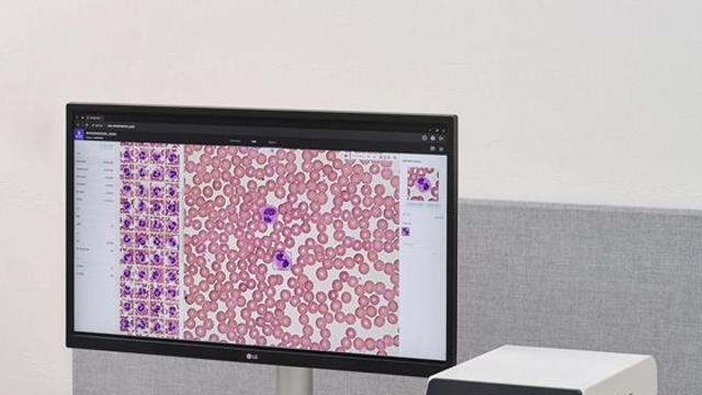 노을, CBC 통합 AI 혈액 분석 신제품 대만 첫 공급…3년간 40억 규모 계약