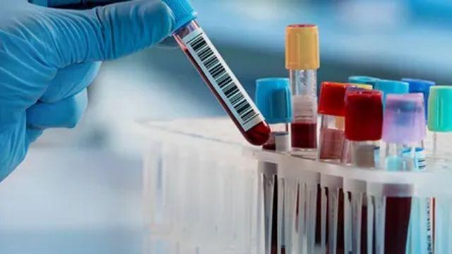 엔젠바이오, 자회사 엔젠파마 흡수합병…종합 헬스케어 플랫폼 확장