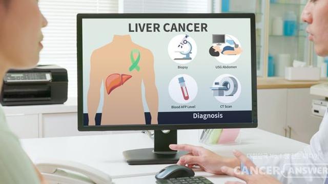 간세포암 '리보세라닙+캄렐리주맙' 병용요법 효과 탁월