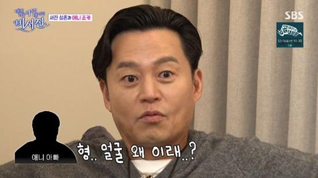 이서진 이마 흉터, '신세계家'서 생긴 흑역사였다 