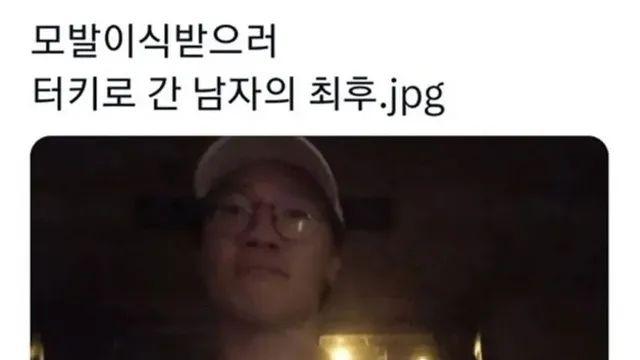 터키로 모발이식 받으러간 남성.jpg,,