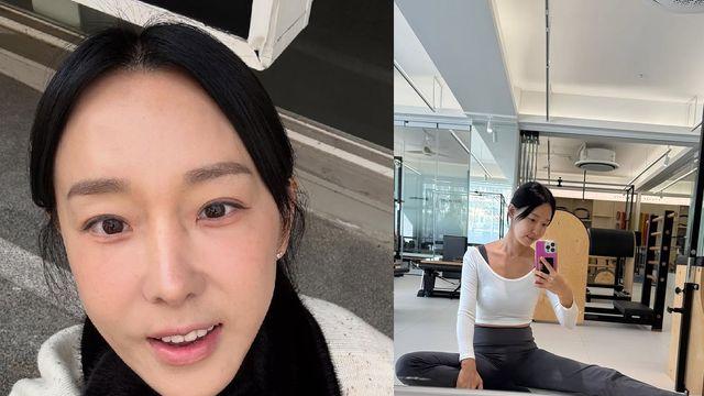 '4cm 인중 축소' 이지혜, 성형 후 관리 철저…