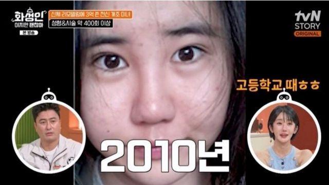성형 수술에 3억을 썼다는 여성