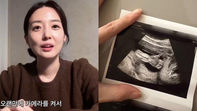 김소영, 핼쑥해진 탓은 입덧 때문