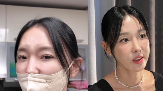 '인중축소술' 이지혜, 달라진 얼굴 신경 쓰였나…집에서 마스크 착용 '자체 모자이크' [엑's 이슈]