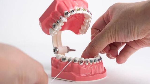 치아교정 해지했는데 '환급액 0원'…급증하는 치과 분쟁