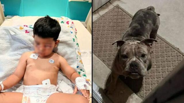 길 잃은 개 문 열어줬다가…3살 아이 얼굴 물어