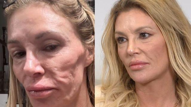 모델 출신 女스타, ‘기생충 감염’으로 안면 변형 진단 받아 “지옥 같았던 시간”