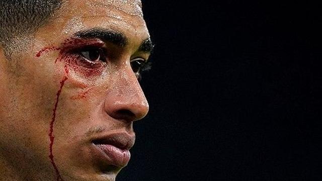 레알 마드리드 이럴 수가! '19년 만의 치욕' 맛봤다…'2명 퇴장' 레알 마드리드, 셀타 비고에 0-2 완패→맨시티전 앞두고 초비상