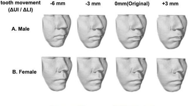 치아 교정, 여성이 남성보다 만족도 낮아…이유는 '이것'