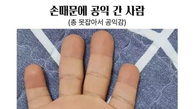 손 때문에 공익 간 사람.jpg