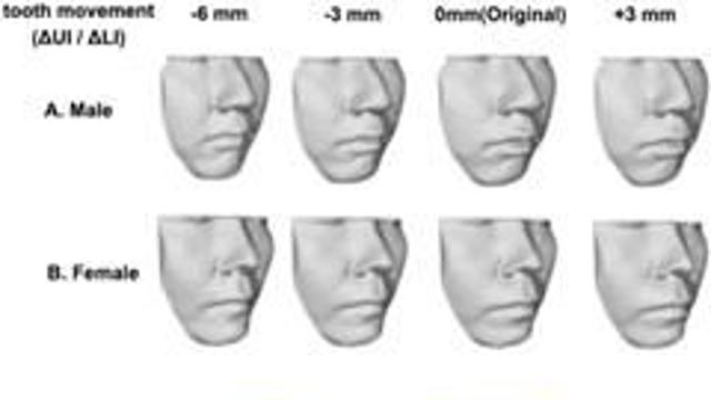 성인 교정 환자 치료 만족도 성별·연령 차이 확인…임상 지침 마련 근거