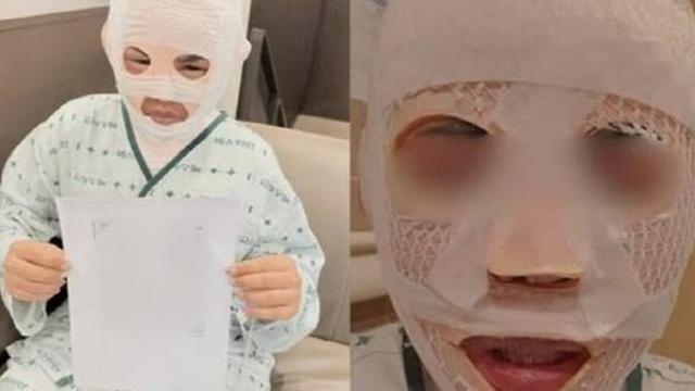 서울, 태국 여친 얼굴에 끓는 물 부은 남성