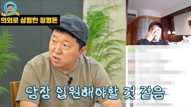 정형돈, '눈밑지방재배치' 수술 직후 모습 공개하며 