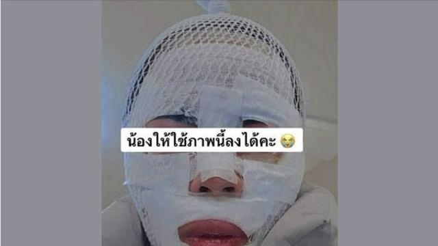 [속보] 아내 얼굴에 끓는 물 부은 남편 