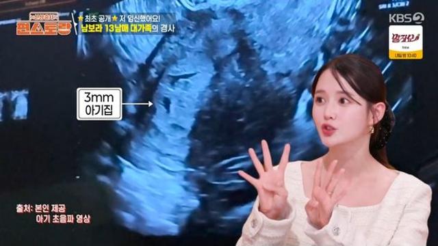 ‘임신’ 남보라 “태명은 콩알탄, 태몽은 가오리꿈” (편스토랑)