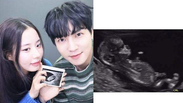 최현석 셰프, 할아버지 된다…최연수♥김태현, 결혼 3개월만 임신