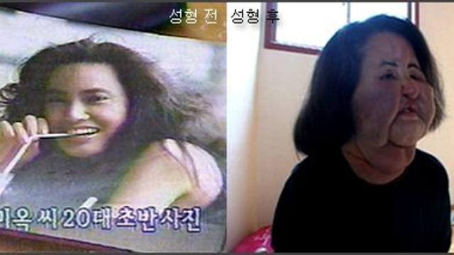‘선풍기 아줌마’ 故 한혜경 7주기… 불법 성형이 남긴 비극