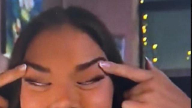 현직 정치인들이 인종차별로 연대중