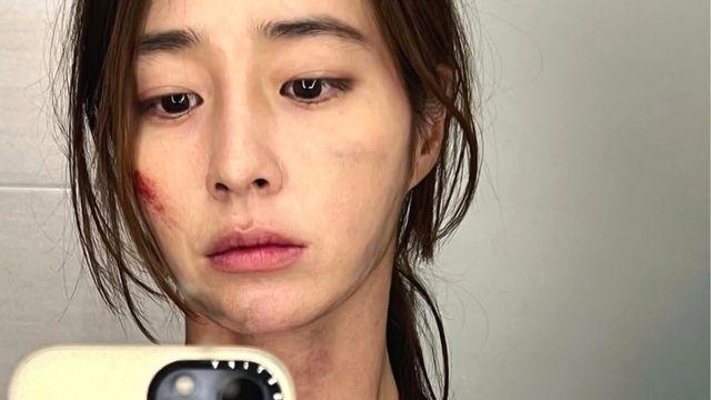 ‘이병헌♥’ 이민정, 잘 사는 줄 알았는데…상처투성이 됐다