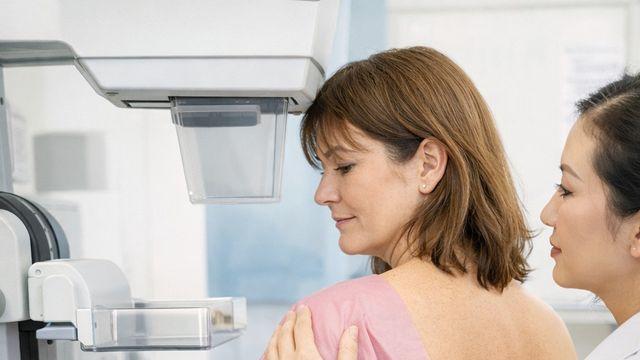 [위클리 건강] 유방암 검진, 40세면 무조건?…