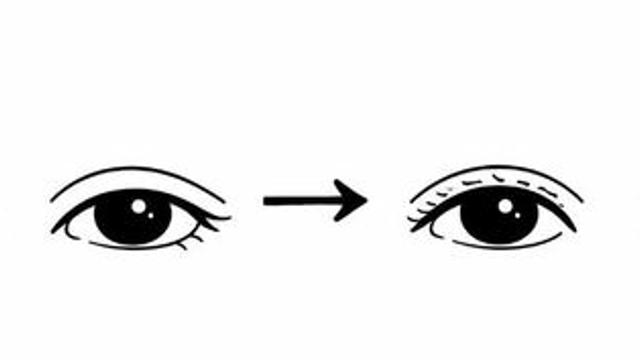 30대 얼굴에 나타나는 노화의 증거