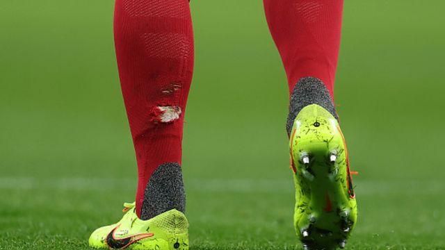 스타킹이 찢어질 정도로 밟았는데? 토트넘 감독은 “난폭한 태클 아니야, 레드카드 마음에 들지 않아”