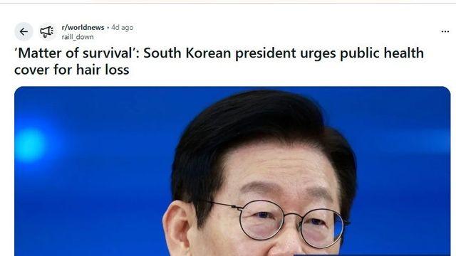 한국, 탈모에 건강보험 적용 추진 소식에 해외 반응