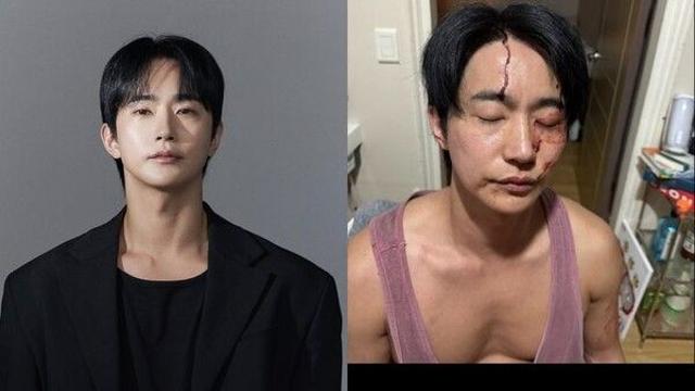 '前연인 폭행 혐의' 전호준, 불기소 처분…