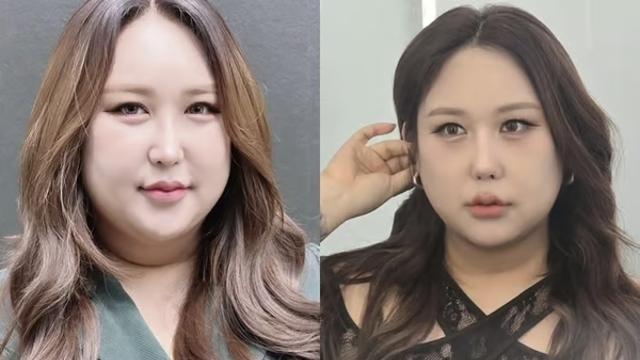 풍자, 갈비뼈까지 사용한 '충격' 5번째 코 성형 고백…