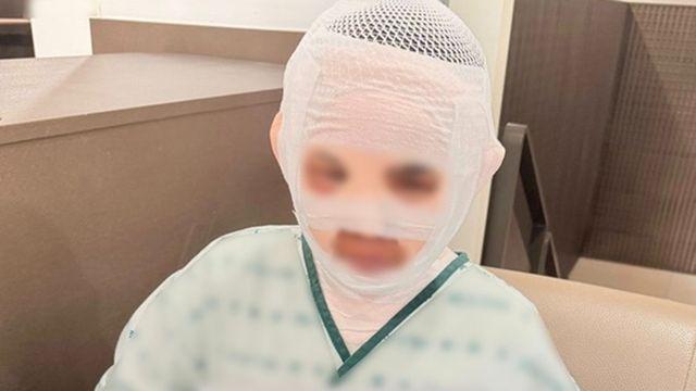 태국인 아내 얼굴에 '끓는 물' 부은 한국인 남편 구속 송치…“끝내 혐의 부인”