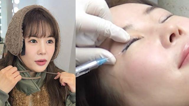 장영란, 어려진 이유 있었다…또 성형? 눈에 주삿바늘 들어와도 '묵묵'