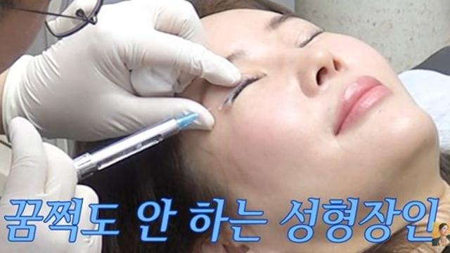 '쌍꺼풀만 4번' 장영란, 눈 수술 또 했다…초대형 주사기 등장 '깜짝' (A급 장영란)