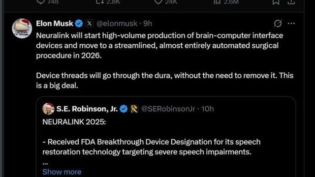 머스크 '뉴럴링크', 2026년 뇌·컴퓨터 연결장치 대량 생산