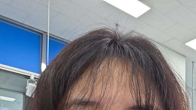 허안나, 난자 채취하는데 술 찾다가… “철없어” 누리꾼 지적