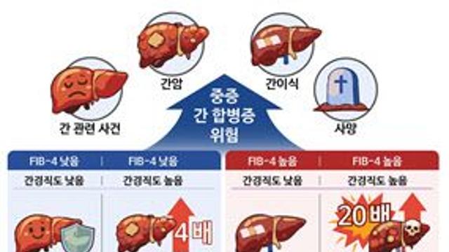 대사이상 지방간 환자, 간경직도 높으면 합병증 위험 높아