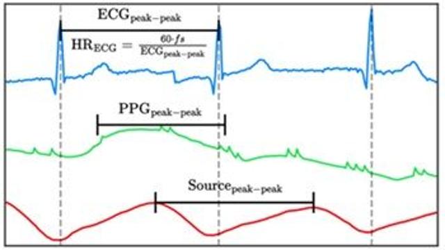 잡음 많은 광용적맥파에서도 심박수 분석 정확도 높이는 AI…실제 환경 적용 가능성 제시