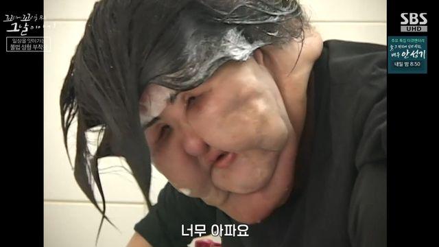 '선풍기 아줌마', 얼굴도 삶도 산산조각…불법 시술→얼굴에 콩기름 꽂았다 '경악' (꼬꼬무)[종합]