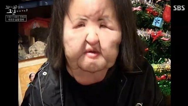 "콩기름 주사·불법 시술"…'선풍기 아줌마' 충격적 삶, 정신 질환까지 밝혀졌다 (꼬꼬무)[종합]