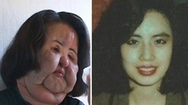 '선풍기 아줌마' 故한혜경, '꼬꼬무'서 숨겨진 삶 전격 조명...반복 불법시술 뒤 숨겨진 진실 공개